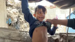 A child smiles as his father pulls up his shirt to show the BBC the bites on his chest