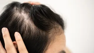 How GLP-1s are helping the hair care industry