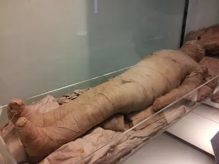 1500年前就有剖腹產！女木乃伊腹部有「17cm縫合傷口」