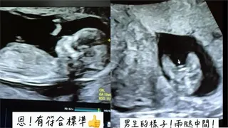 熊熊產檢二寶性別曝光！命理師「驚人預言全命中」她興奮喊：請受我一拜