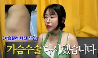 李世英施打填充物美胸，結果竟掉到肋骨，左圖為填充物掉落的模樣。（圖／翻攝自YouTube）