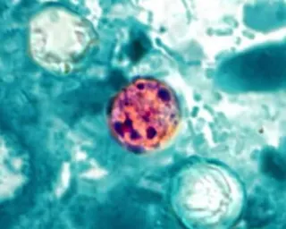 A microscope image shows a round pinkish-purple Cyclospora cayetanensis cell surrounded by blue-green cells